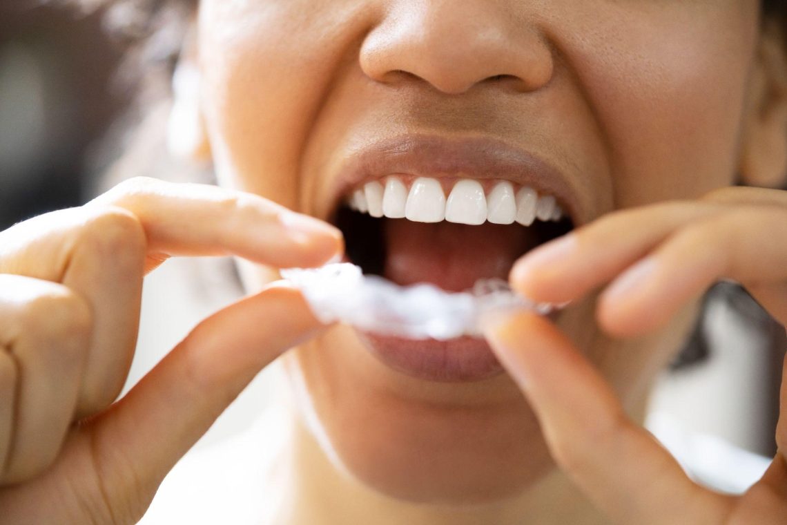 Teeth