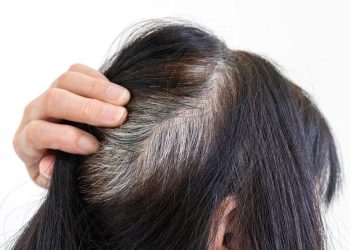 Wellhealthorganic.com/know-the-causes-of-white-hair-and-easy-ways-to-prevent-it-naturally