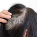 Wellhealthorganic.com/know-the-causes-of-white-hair-and-easy-ways-to-prevent-it-naturally