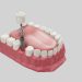 Embracing Confidence: The Revolution of Dental Implants in Sydney