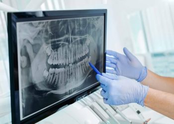 How Digital X-Rays Enhance Diagnosis and Improve Endodontic Outcomes
