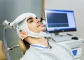 TMS for Depression